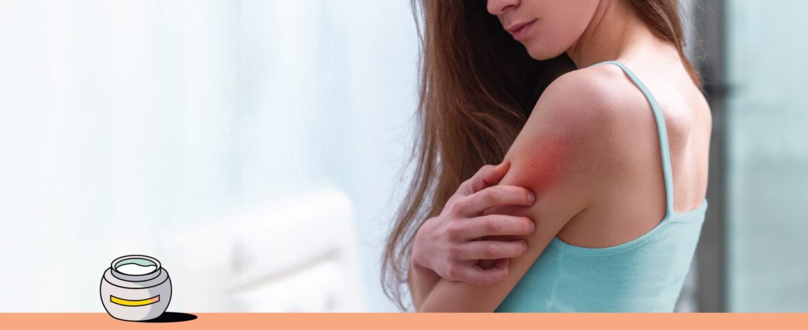 Hives: the alarm bells of our body